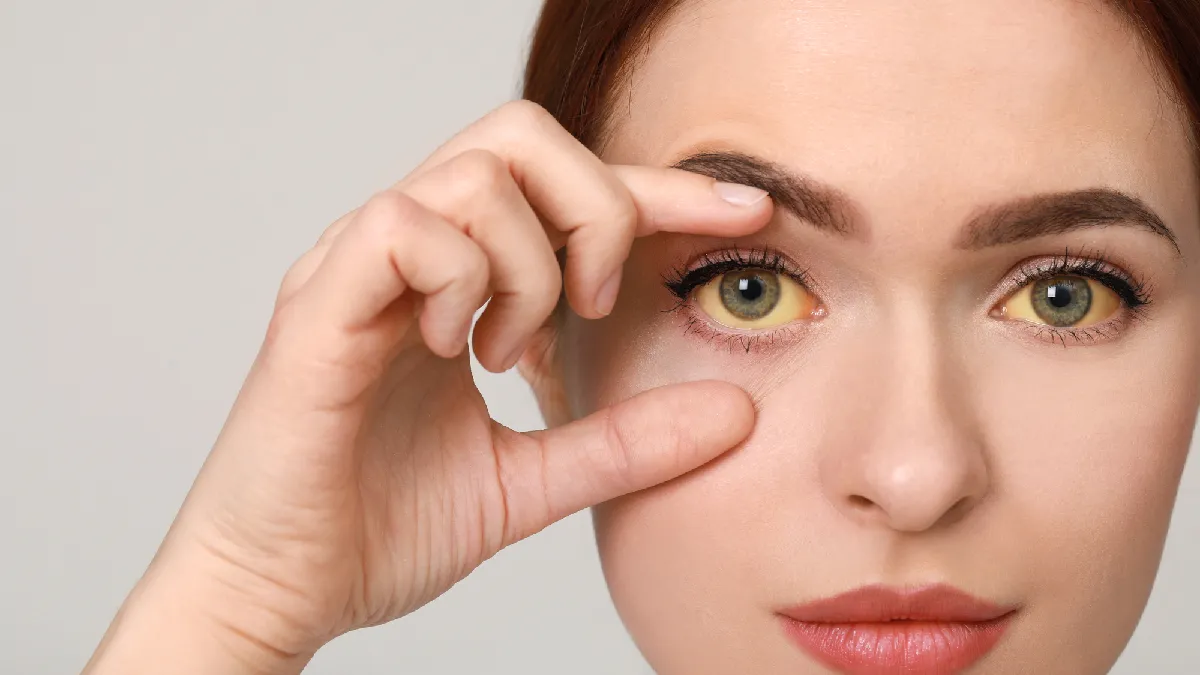 Principais tipos de hepatite, sintomas e como se proteger