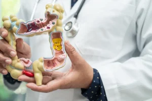 Câncer intestinal: prevenção, diagnóstico e tratamento