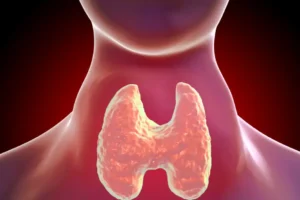 Câncer de tireóide