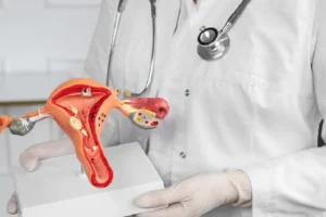 Endometriose: sintomas, diagnóstico e tratamento