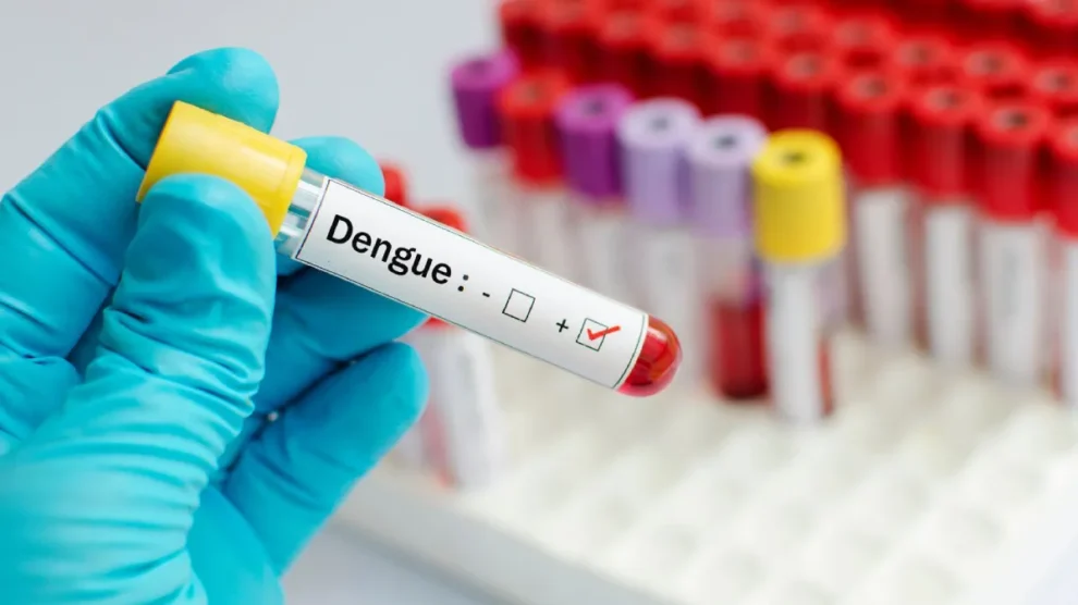 Dengue: a eficiência dos testes de sorologia e a inovadora vacina QDenga