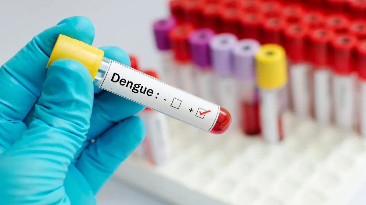 Dengue: a eficiência dos testes de sorologia e a inovadora vacina QDenga