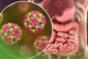 Norovírus: o que é, como identificar os sintomas e prevenir a infecção