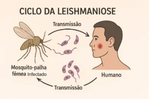 Leishmaniose