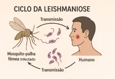 Leishmaniose